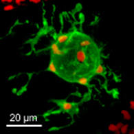 融合して異物を包囲化するヒトデ幼生の免疫細胞（緑）（赤は核を示す）