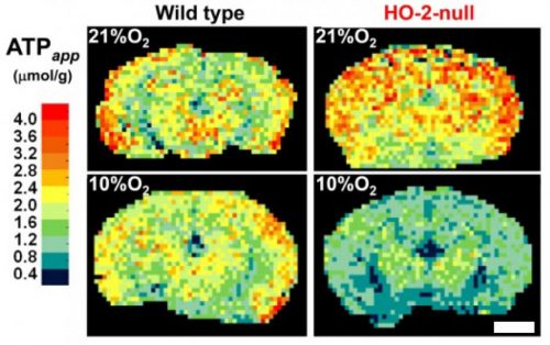 マウスの脳で作られるATPの画像化：定量的質量分析イメージング