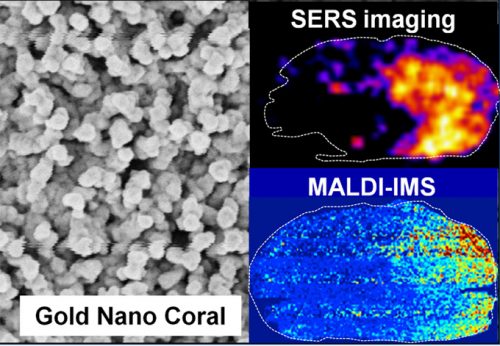 Gold nano coral (GNC)を利用した表面増強ラマン散乱と生体分子イメージング